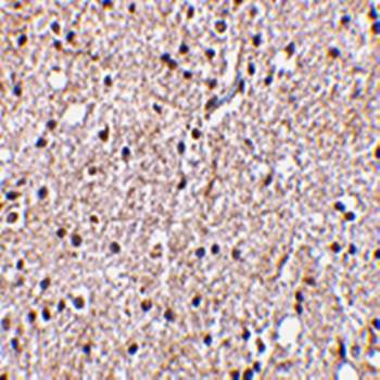 BRSK2 Antibody