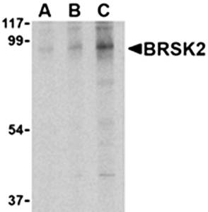 BRSK2 Antibody