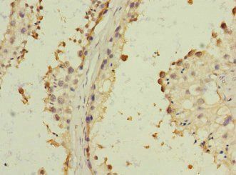 BST1 Antibody