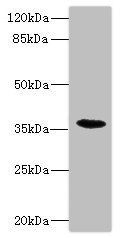 BST1 Antibody