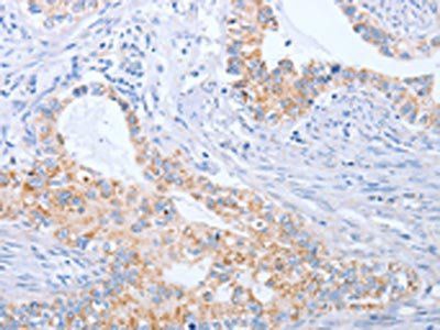 BST1 Antibody
