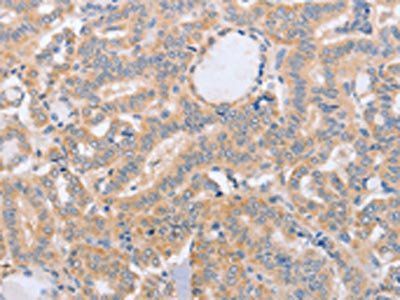 BST1 Antibody