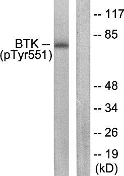 BTK (Phospho-Tyr551) Antibody