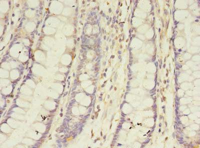BTN2A1 Antibody