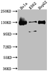 BUB1 Recombinant Monoclonal Antibody