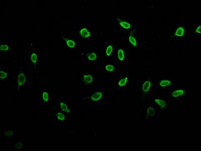 Butyrly-HIST1H3A (K23) Antibody