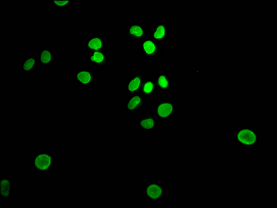 E2F1 Recombinant Monoclonal Antibody