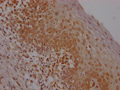 E2F1 Recombinant Monoclonal Antibody