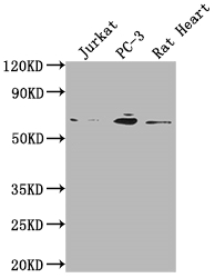 E2F1 Recombinant Monoclonal Antibody