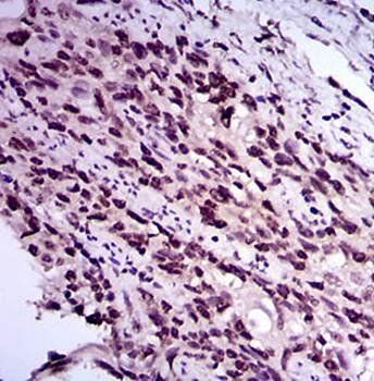 E2F1