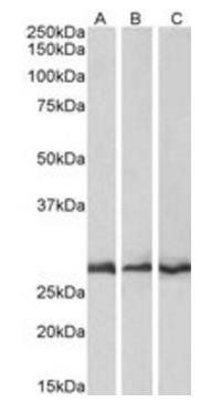 CAPZB Antibody