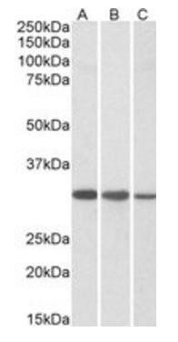 CAPZB Antibody