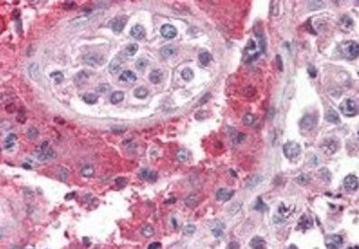 SET/I2 alpha PP2A Antibody