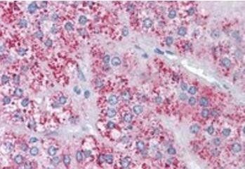 Goat anti-MTA1 Antibody