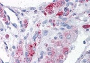 Goat anti-MTA1 Antibody