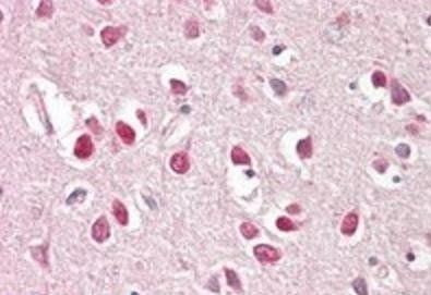 BAIAP2 (isoform 3) Antibody