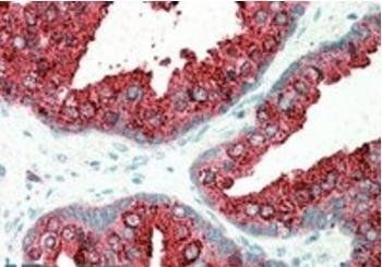 ELMO3 Antibody
