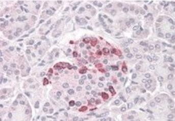 SOCS4 Antibody