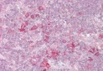 MST4 Antibody
