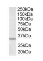 ING2/ING1L Antibody