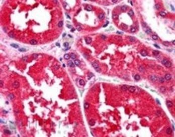 Aldehyde Reductase Antibody