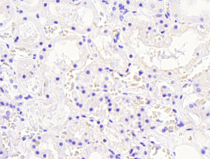 Aldehyde Reductase Antibody