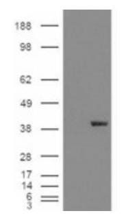 Aldehyde Reductase Antibody