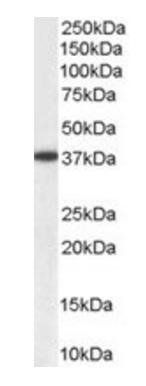Aldehyde Reductase Antibody