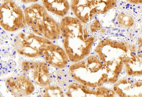 Aldehyde Reductase Antibody