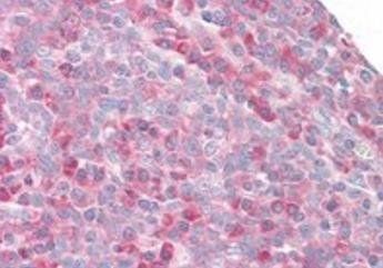 MPS1/RPS27 Antibody
