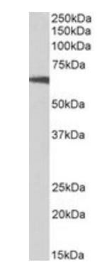 p70S6K/RPS6KB1 Antibody