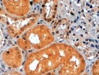 p70S6K/RPS6KB1 Antibody