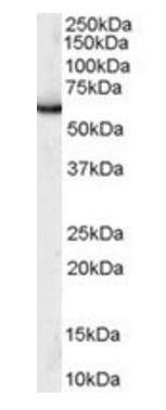 SIAHBP1/FIR Antibody