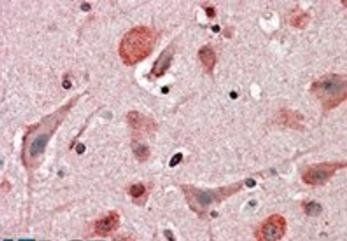 HIP2 Antibody
