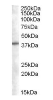 SNX16 Antibody