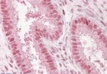 Npap60/Nup50 Antibody
