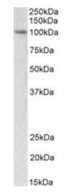 ICBP90/UHRF1 Antibody