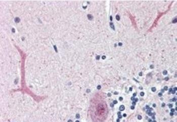 FOXC1 (C Term) Antibody
