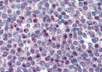 FOXC1 (C Term) Antibody