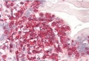 Coronin 1/TACO Antibody