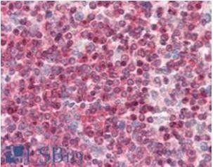 Coronin 1/TACO Antibody