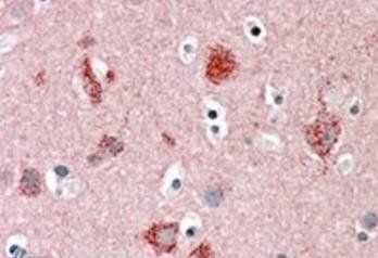 MUNC18/STXBP1 (isoform a) Antibody