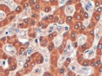 Syntenin 2 Antibody