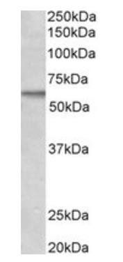 Goat anti-Activin receptor-like kinase 1 Antibody