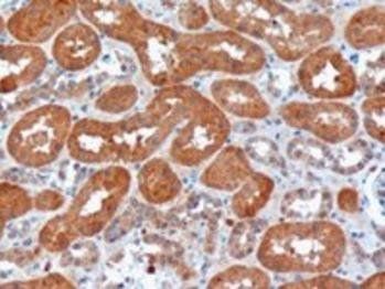 USH1C/Harmonin Antibody