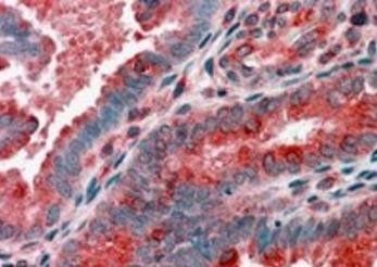 ARP1 homolog B Antibody