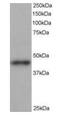 ARP1 homolog B Antibody