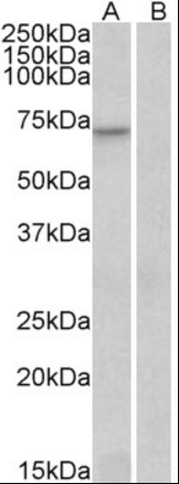 FOXO3A/FOXO3/FKHRL1 Antibody
