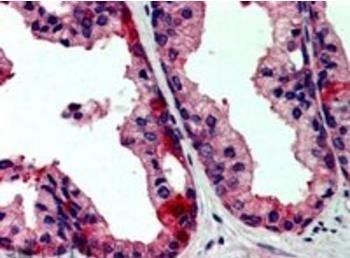 JIK/TAOK3 Antibody