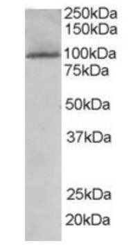JIK/TAOK3 Antibody